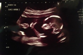 Thumbs-Up Ultrasound & More Incredible Links
