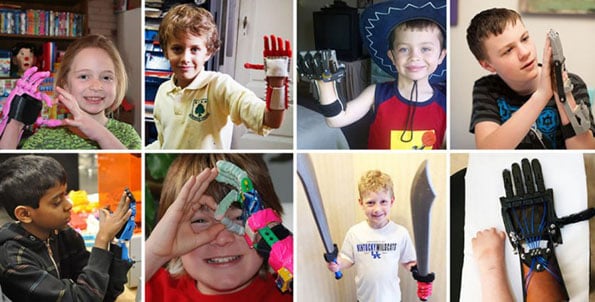 3d-printed-superhero-prosthetic-arm-kids-3