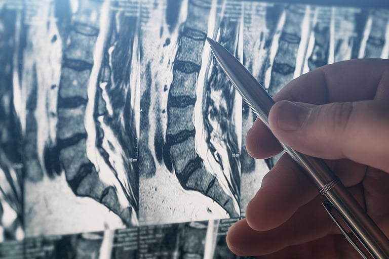 Dr. Thomas Frimpong Explains What Patients Need to Know About Spinal Surgery in 2021