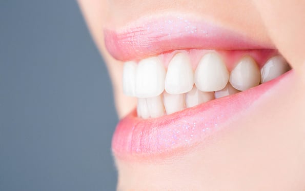 Perfect healthy teeth. Closeup shot of womans toothy smile. Perfect healthy teeth smile woman. Teeth Whitening. Dental health Concept. Teeth whitening procedure. Dental care. Dentistry concept