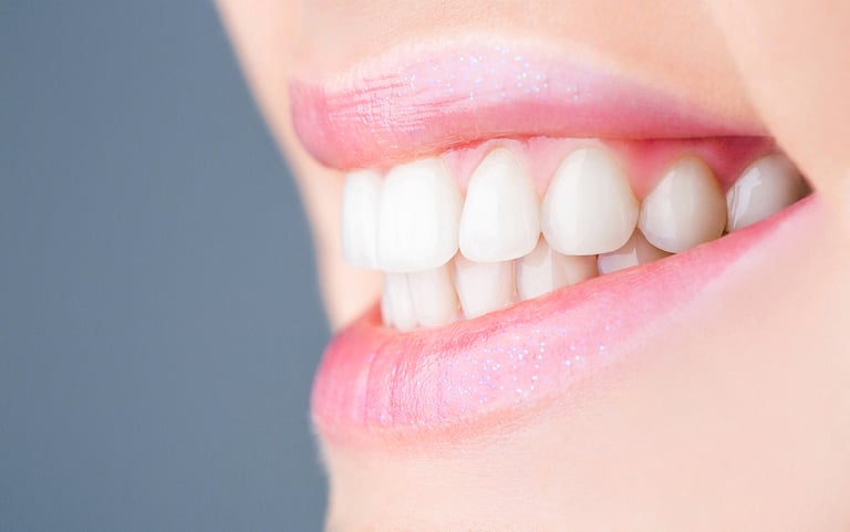 Boost Self Confidence With Proper Dental Health