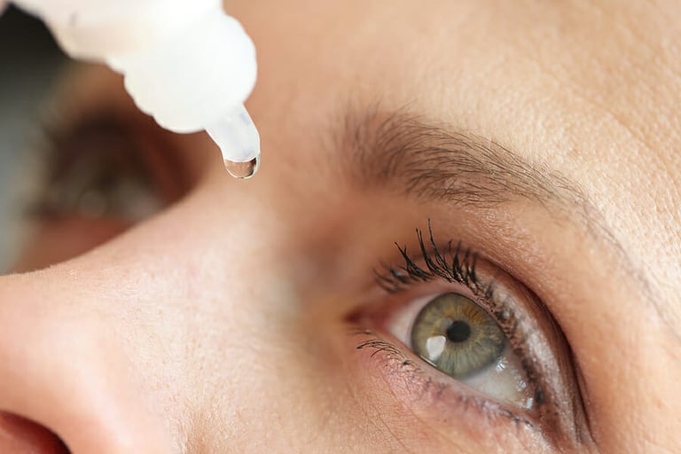 Caucasian woman using medical drops and dripping eye close up. Dry eyes syndrome, eye diseases and medical treatment concept.