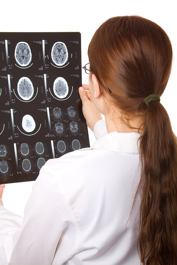 Brain Stem Injuries: Causes, Symptoms, and Treatment   