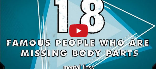 Interesting!: Famous People Missing Body Parts
