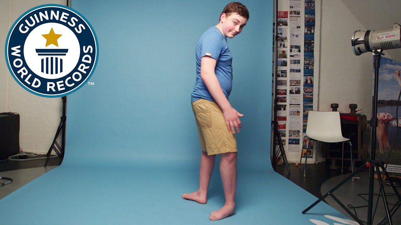 This Teen Can Bend His Feet Backwards And It Is CRAZY