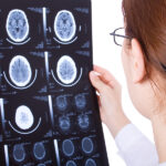 Common Causes of Washington Brain Injuries