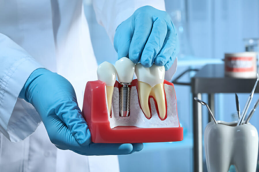 What are the Most Common Complications of Dental Implants?