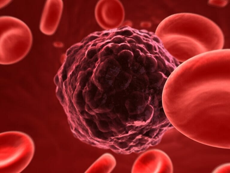 Cancer: Types and Adjunctive Treatment